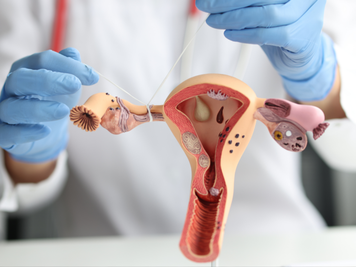 How Do Fallopian Tubes Get Blocked? Causes And Prevention
